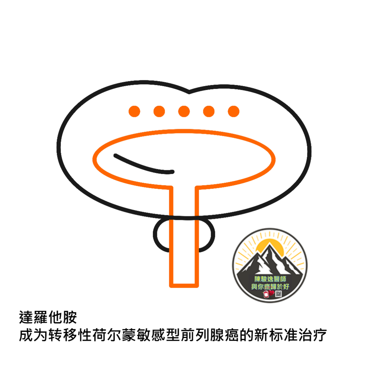 達羅他胺將成為轉移性荷爾蒙敏感型前列腺癌的新標準治療 1 2022112812
