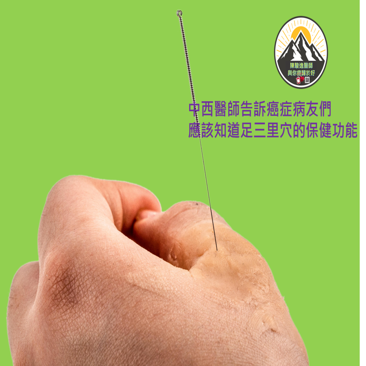 中西醫師告訴癌症病友們 應該知道足三里穴的保健功能 1 005 1