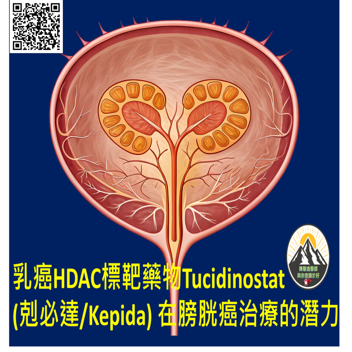 乳癌HDAC標靶藥物Tucidinostat (剋必達/Kepida) 在膀胱癌治療的潛力