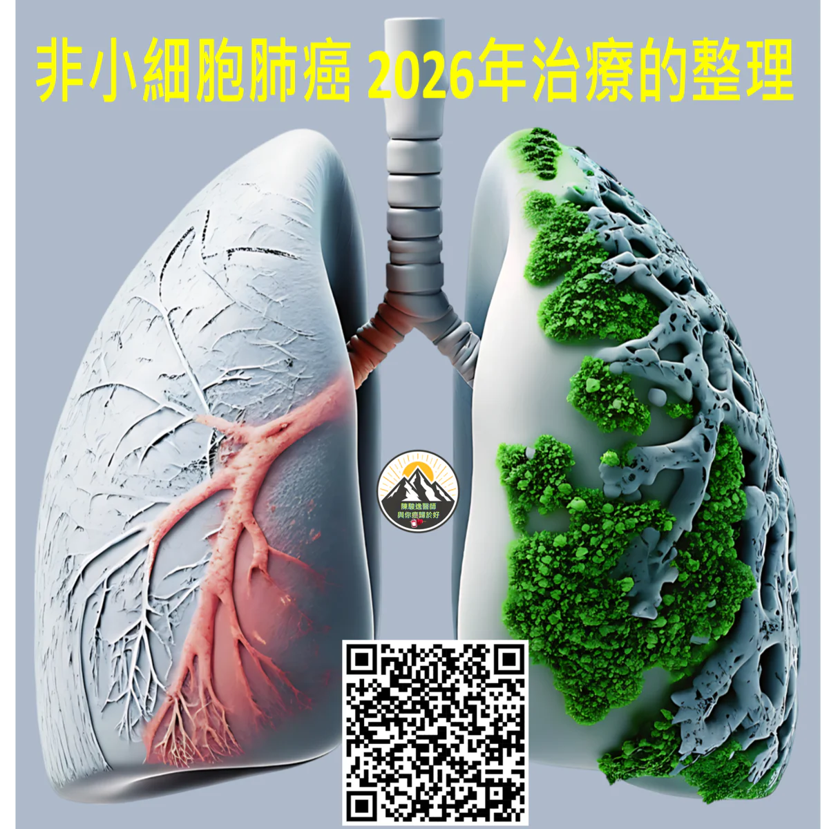 2026051402 1