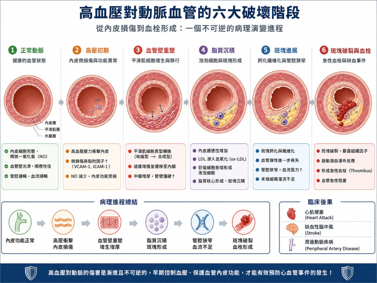 從球場防守到血管重構:腫瘤科醫師看高血壓血管損傷機制與抗血管新生標靶治療之交鋒 1 0019